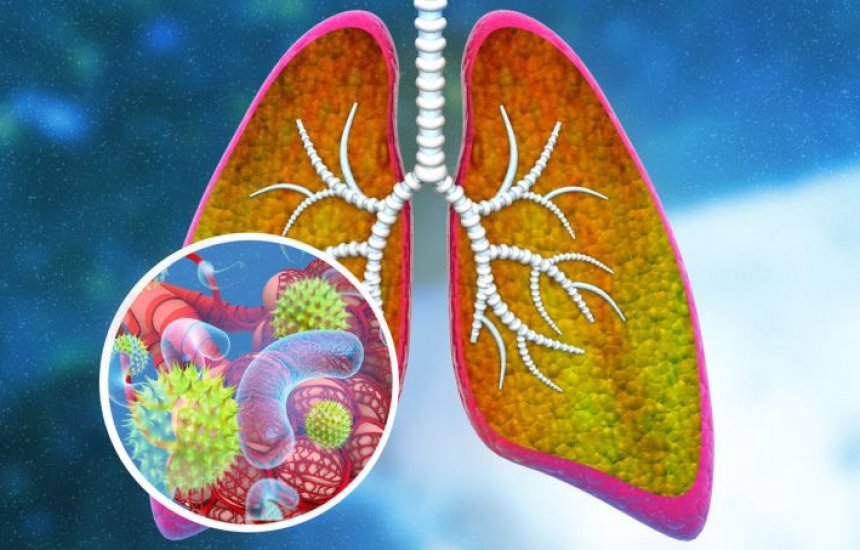 Pneumonia adquirida na comunidade é tema de palestra-aula dia 20/11, na AML